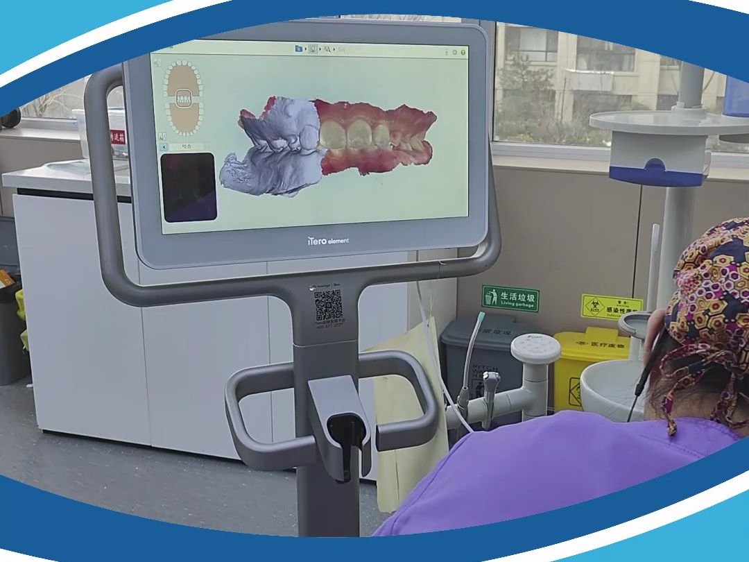 口扫"黑科技" 数字化光学扫描 摆脱传统取模 让口腔治疗更舒适更便捷