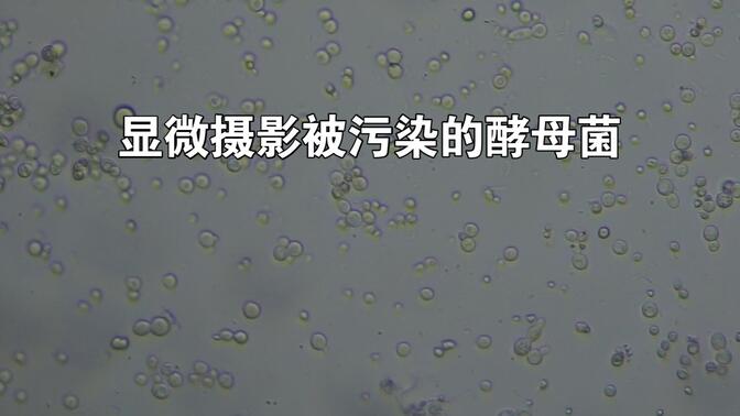 酵母菌污染-哔哩哔哩_bilibili