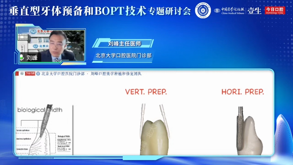 《垂直型牙体预备和bopt技术专题研讨会》刘峰黄翠教授等 口腔技术临床讲座哔哩哔哩bilibili