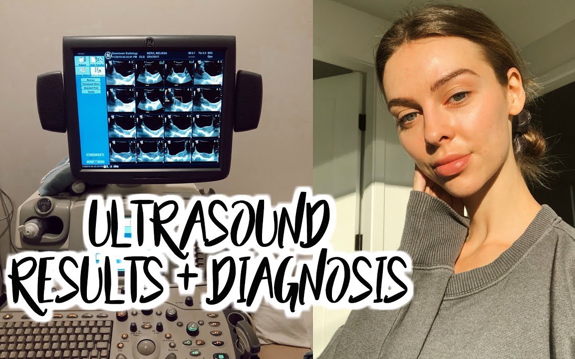 【Melissa Merk】最近日常vlog|Ultrasound Results, Diagnosis, Health Updates, My Plan哔哩哔哩bilibili