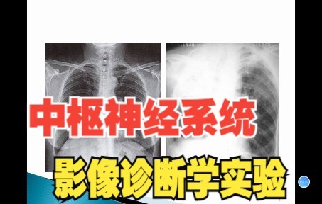 [图]影像诊断学——绪论和中枢神经系统影像学表现（一）