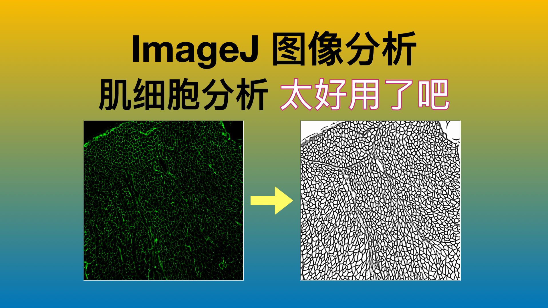 『超实用』ImageJ图像处理  肌细胞处理神器  myosoft哔哩哔哩bilibili