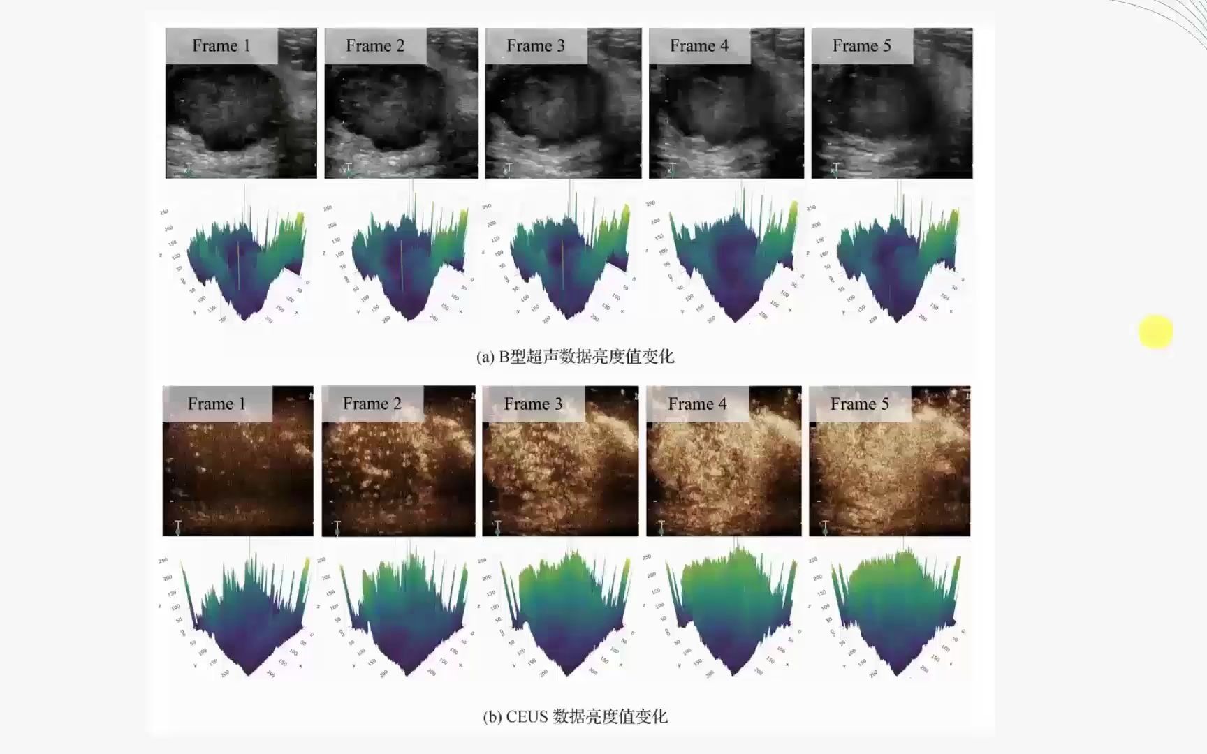 论文阅读:乳腺超声双模态数据的协同约束网络哔哩哔哩bilibili