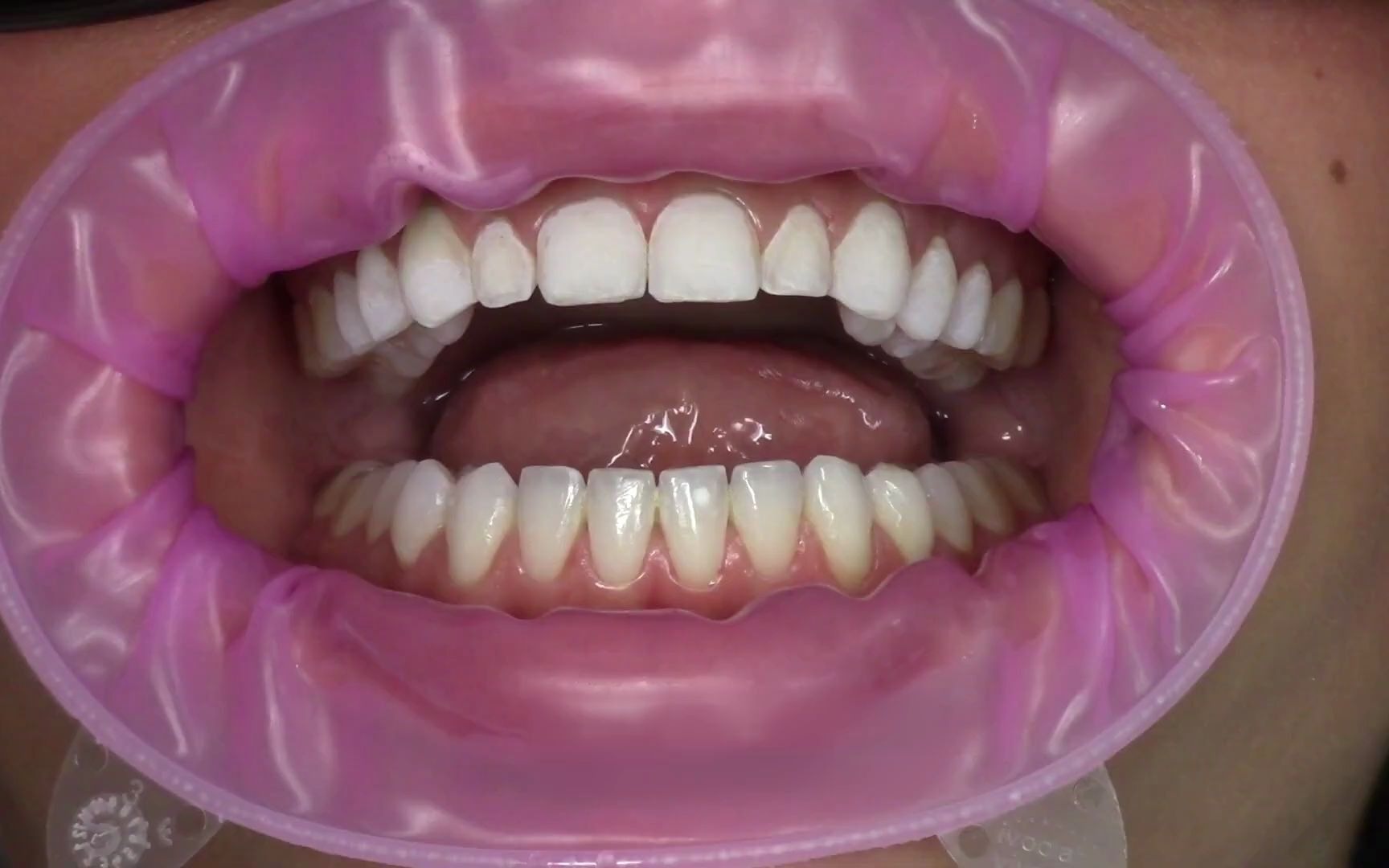 你们想要的唇红齿白~是不是这个样子的?