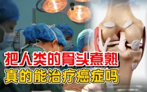 Tải video: 把人类的骨头煮熟，再装回去，真的能治疗癌症吗？