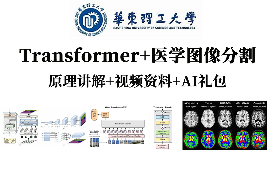 称霸CV界的Transformer到底有多牛!基于transformer的医学图像分割实战,计算机大佬手把手带你精读论文!哔哩哔哩bilibili