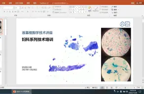 Download Video: 20231128_液基细胞学制片技术-妇科（TCT）