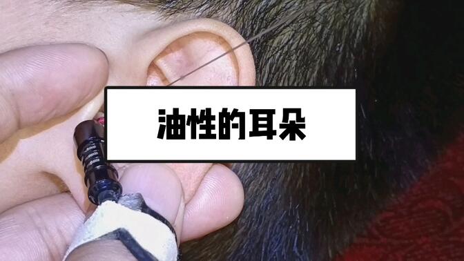 为什么油耳屎有狐臭