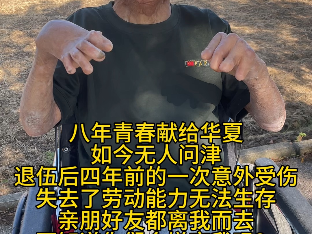 不忘初心 烧伤毁容经历了很多人的冷眼嘲笑与歧视,但我始终坚信,世界上没有黑暗的地方.只有黑暗的人心,只要内心向阳生活将一片光芒.哔哩哔哩...