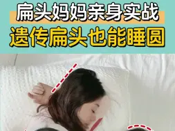 Video herunterladen: 扁头妈妈亲身实战，遗传扁头也能睡圆