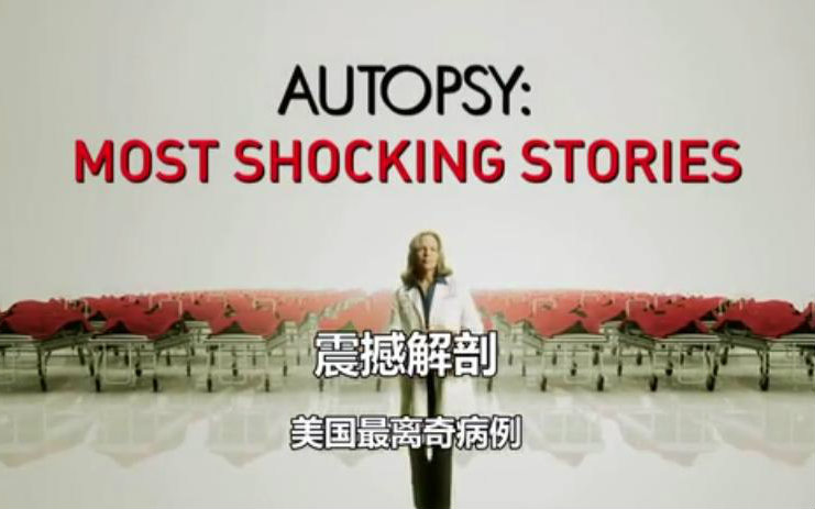 [图]震撼解剖 autopsy most shocking stories