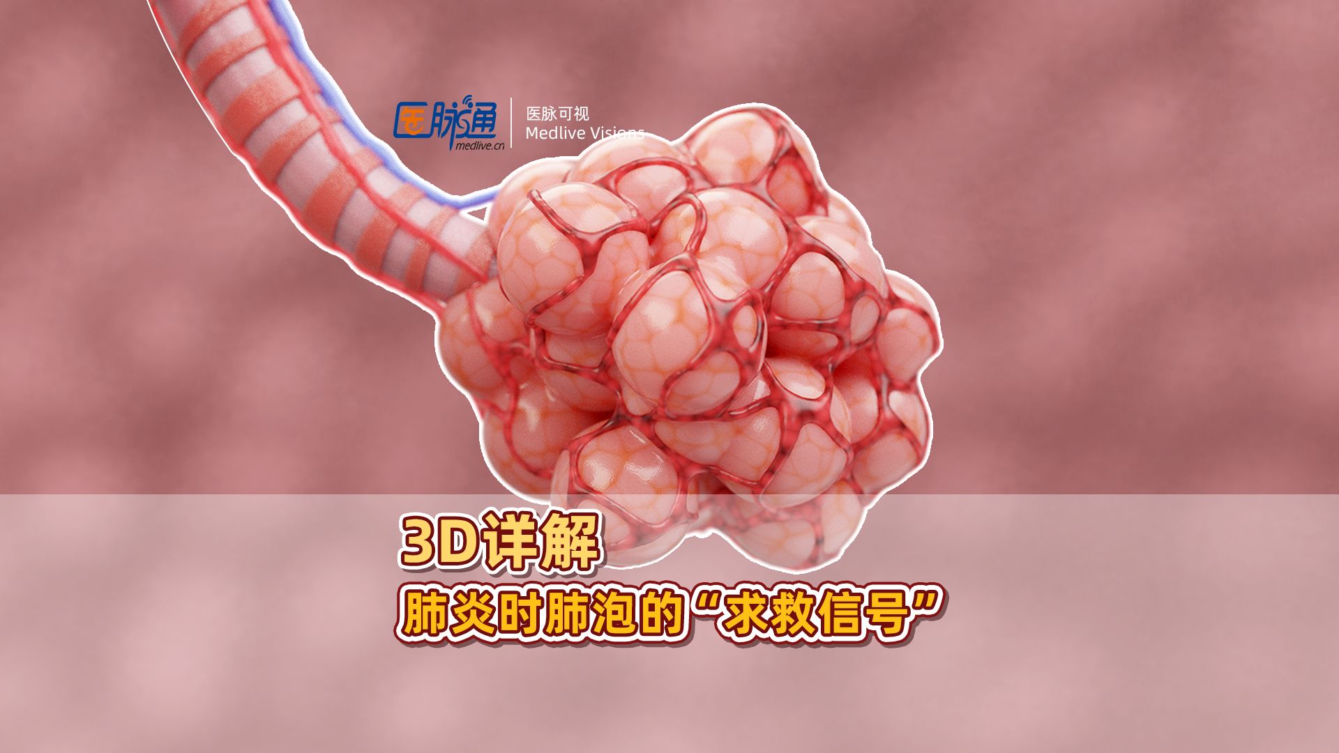 3D详解肺炎的发生机制