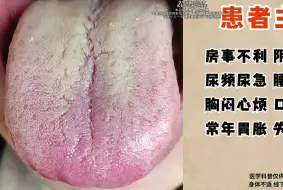 Tải video: 湿热重+脾肾两虚+肝郁，最难调的舌象