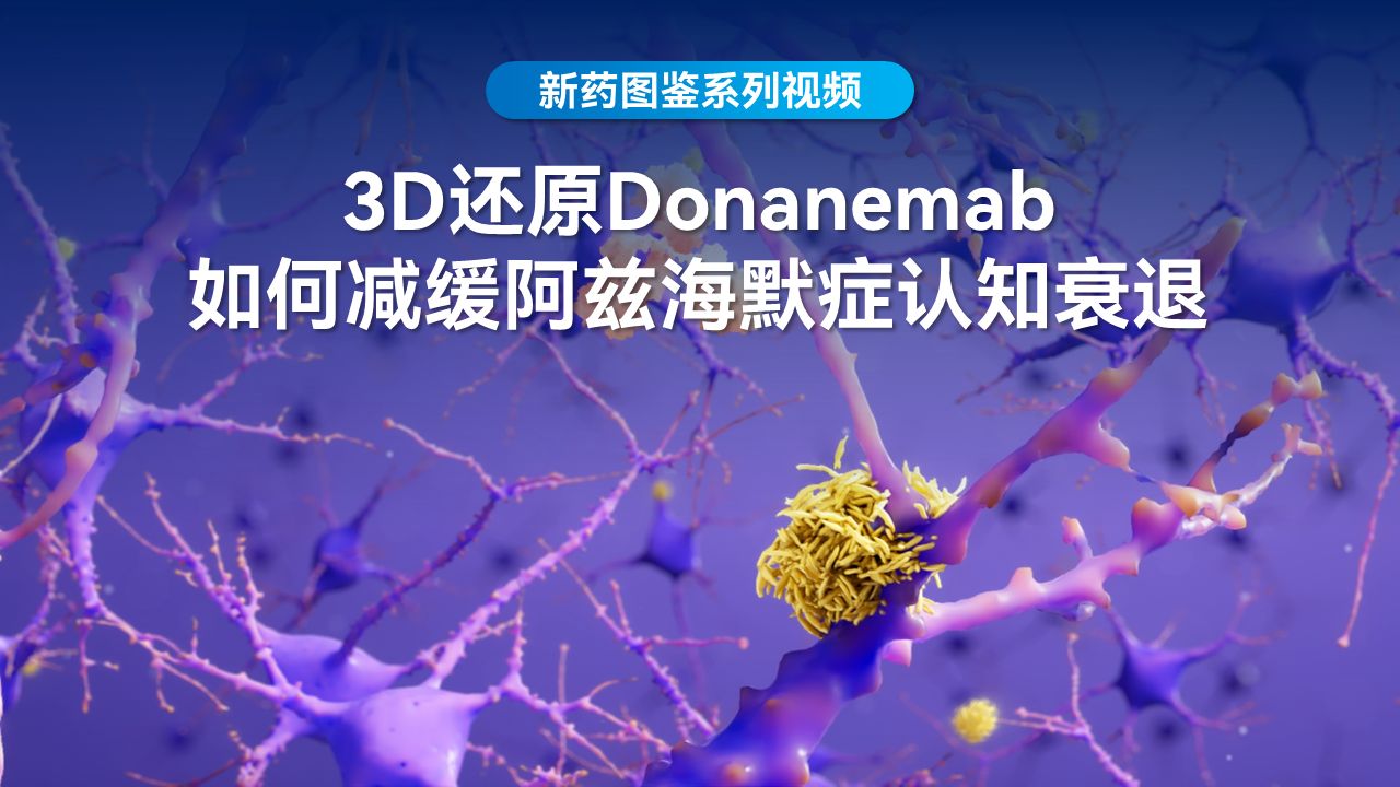 【3d還原】donanemab如何減緩阿茲海默症認知衰退