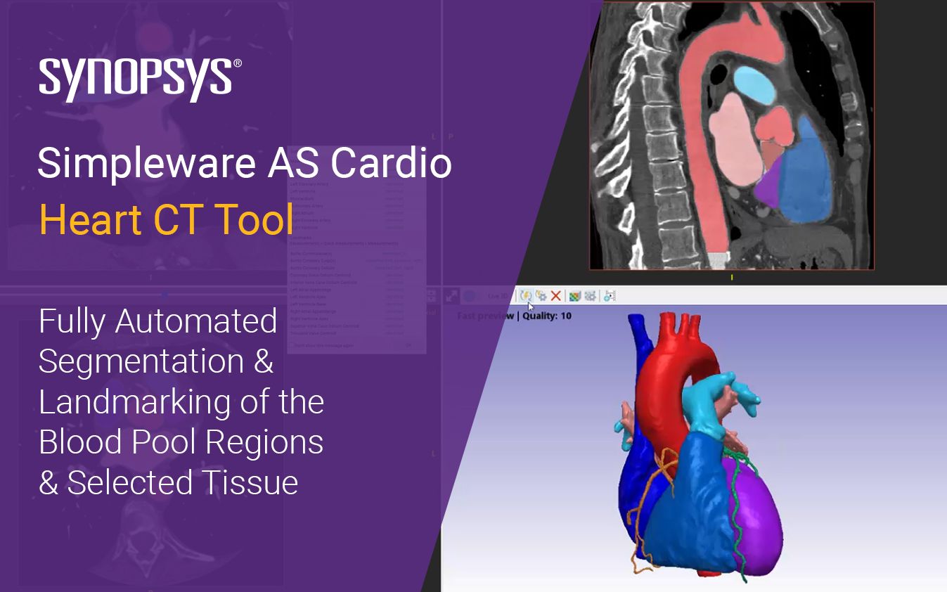 【Simpleware】心脏自动化分割 AS Cardio 模块应用心脏CT哔哩哔哩bilibili