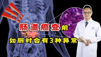 Download Video: 肠道癌变前，如厕时会有3种异常，若一个不占，说明肠道很健康