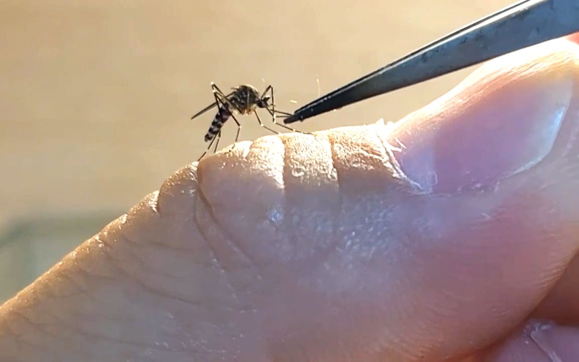 [图]用镊子抓住正在吃自己血的蚊子的口器，并把它分离掉