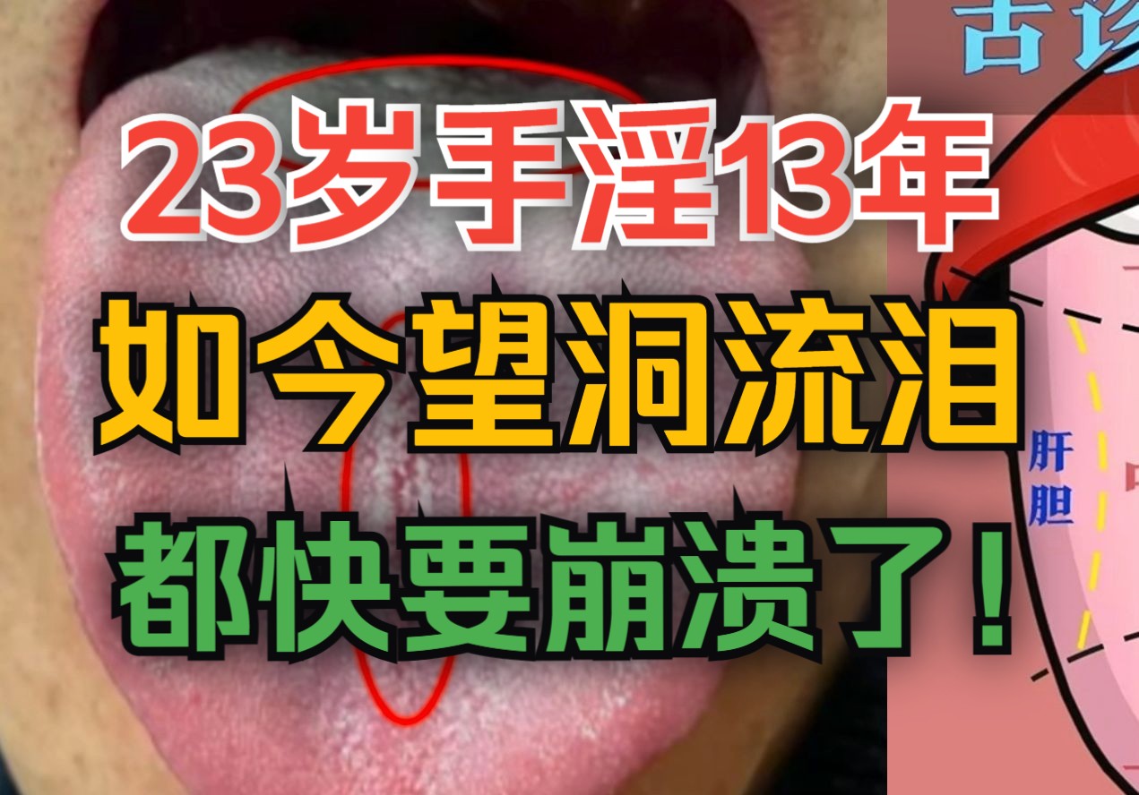 23岁手淫13年,如今望洞流泪,都快要崩溃了!哔哩哔哩bilibili