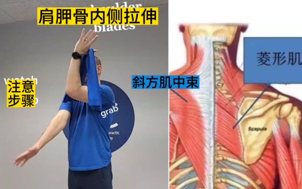 长期久坐弯背,肩胛缝疼痛紧张,菱形肌劳损,运动康复