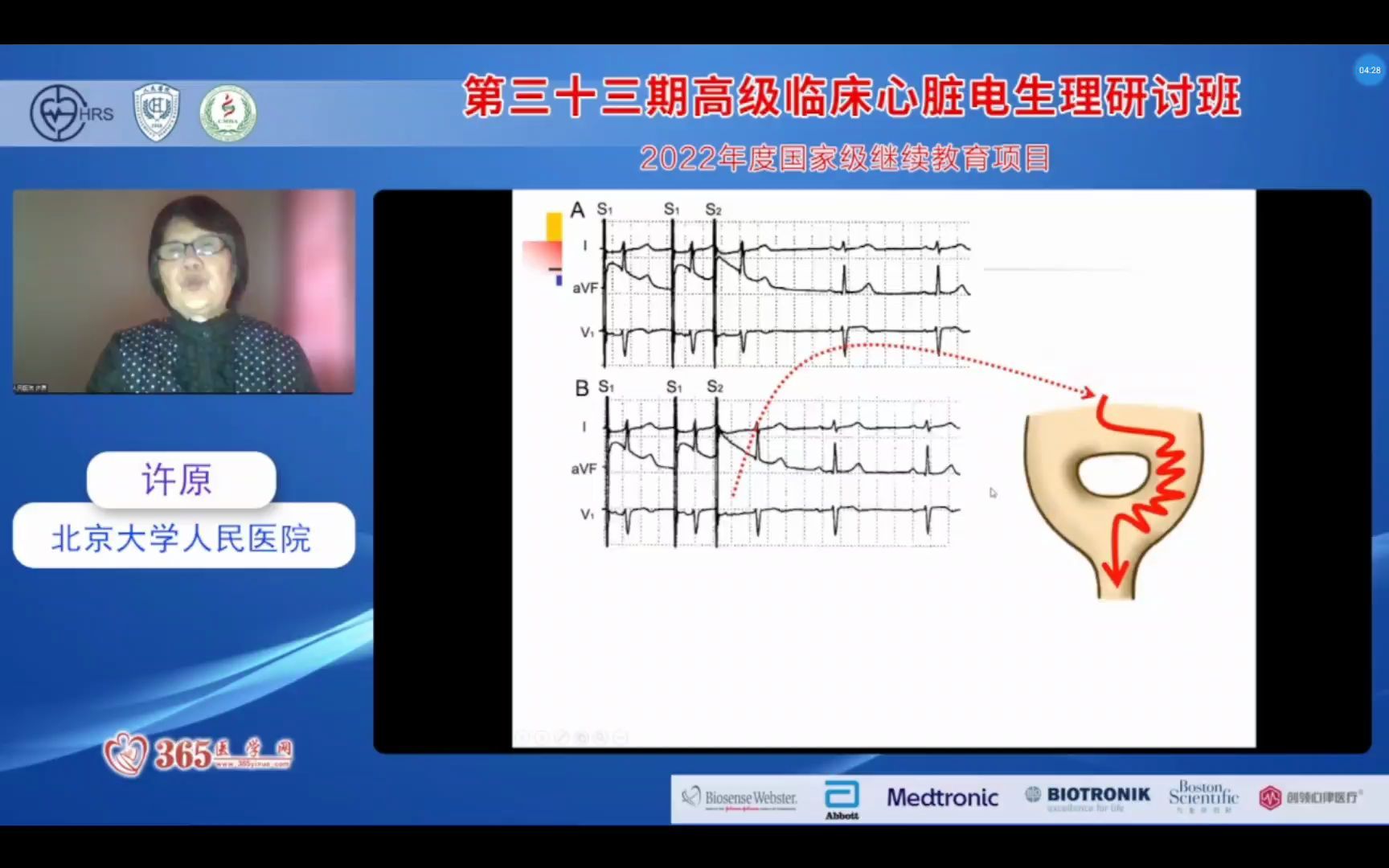 33食道调搏临床应用许原哔哩哔哩bilibili