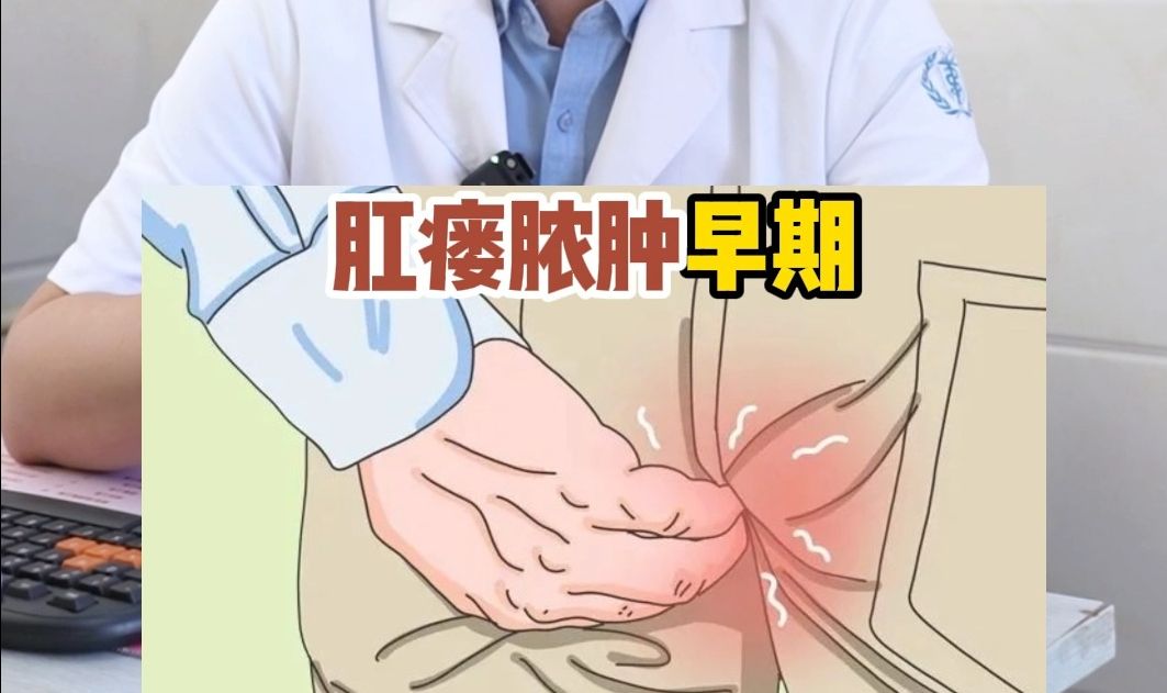 肛周脓肿和痔疮怎么区分?哔哩哔哩bilibili