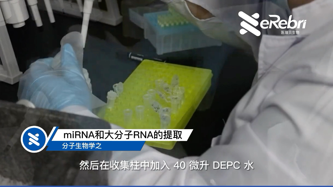 [图]#医瑞贝生物 您的技术实验服务伙伴分子生物学实验——miRNA和大分子RNA的提取（下） #miRNA #大分子RNA #分子生物学 #医学科研