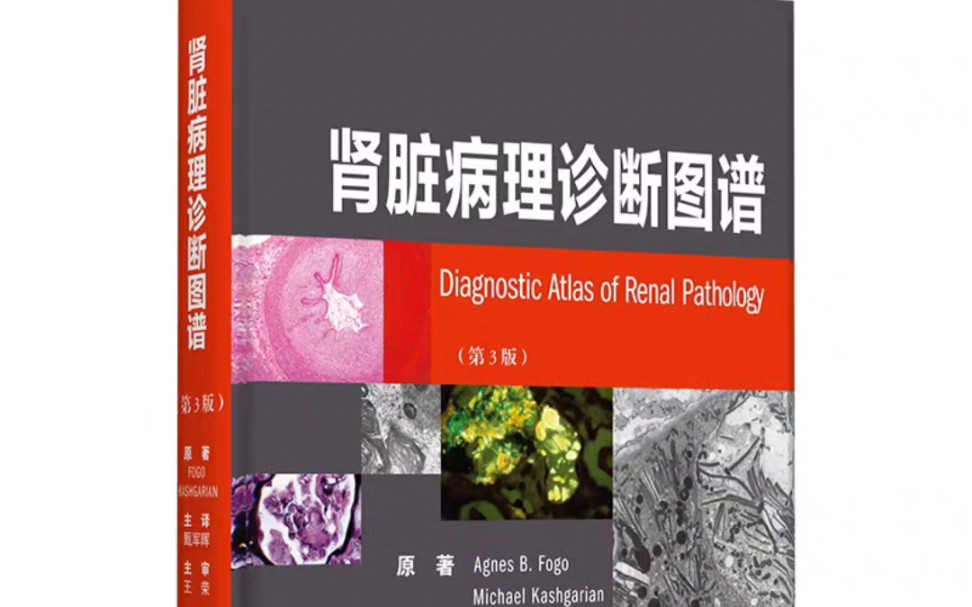 【pdf】肾脏病理诊断图谱 第3版