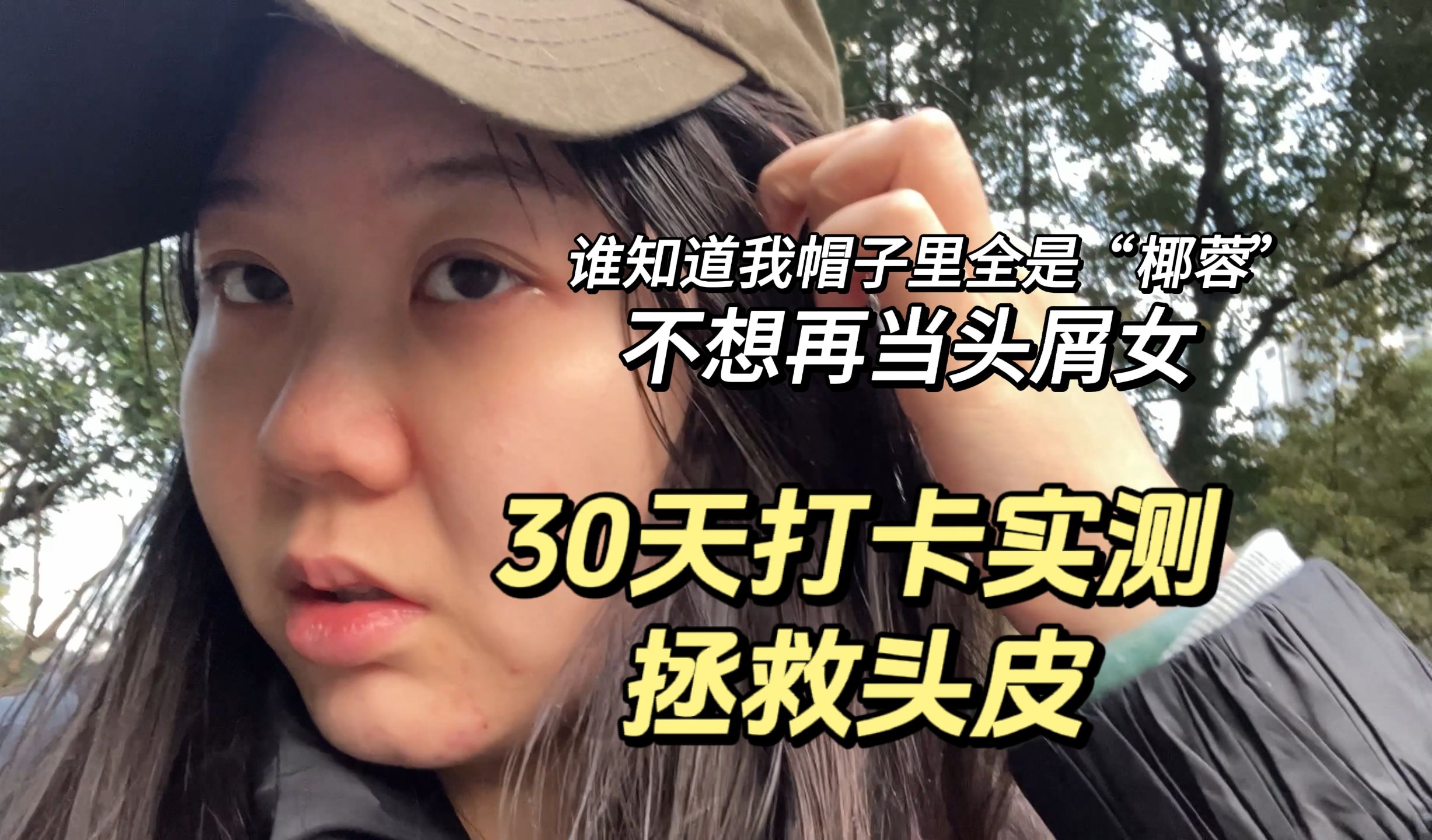 不想再当头屑女 【二硫化硒30天实测打卡】哔哩哔哩bilibili