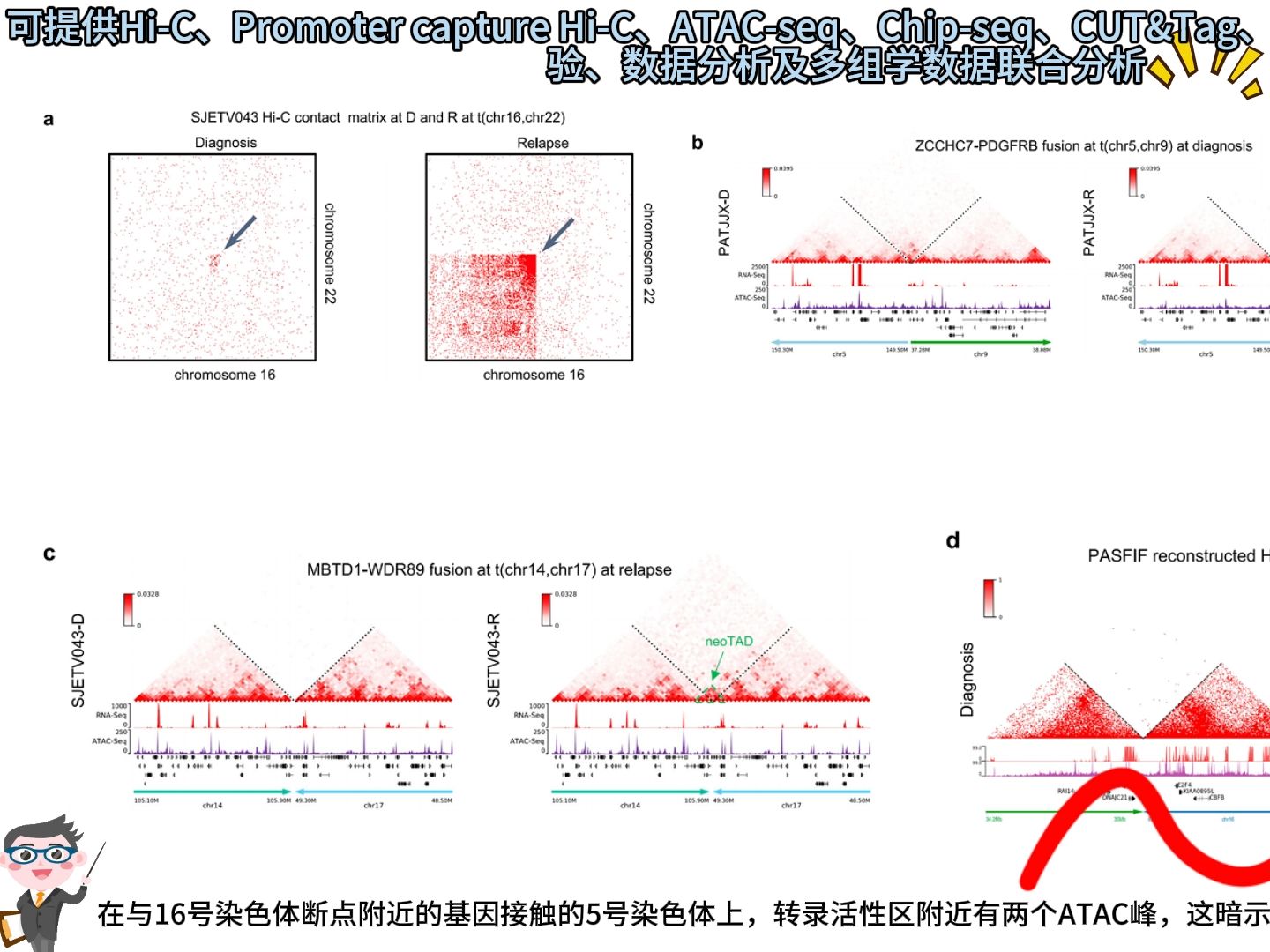 小诺课堂第4期HiC、ATACseq、RNAseq、HiChIP联合解析了儿童白血病进展与3D染色质组织结构变化的关系哔哩哔哩bilibili