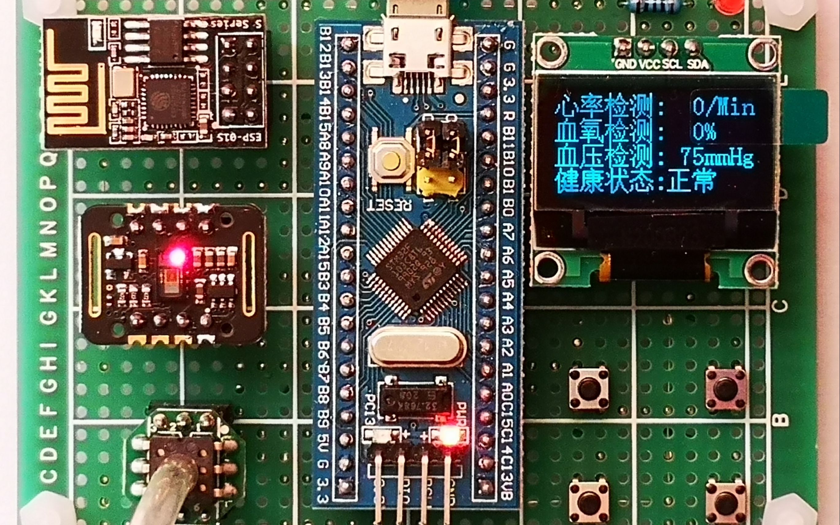 【STM32单片机设计】远程心率血氧血压检测系统 医疗健康监护系统 便携式心率血氧检测仪 WIFI物联网APP远程医疗系统哔哩哔哩bilibili