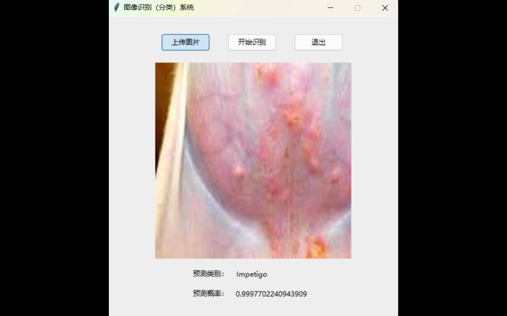 基于卷积神经网络的宠物皮肤病识别系统,resnet50,mobilenet【pytorch框架,python,tkinter】哔哩哔哩bilibili