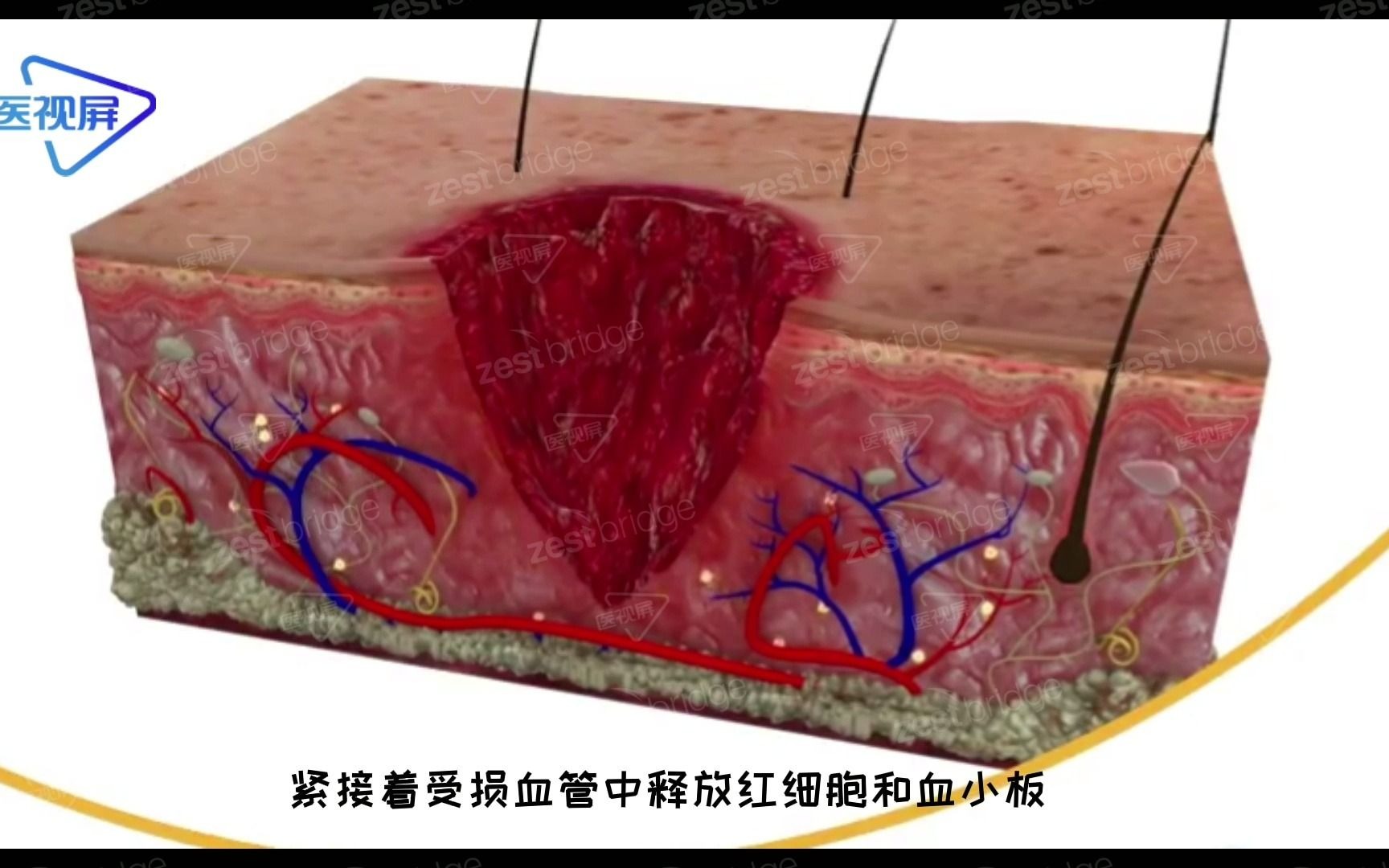 3D还原:伤口愈合全过程哔哩哔哩bilibili