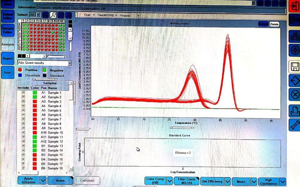 【分子生物学实验】realtime PCR 数据分析、溶解曲线、扩增曲线哔哩哔哩bilibili