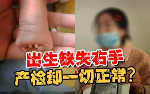 Download Video: 5次产检全部正常 宝宝却右手畸形 宝妈：医生的解释太荒谬