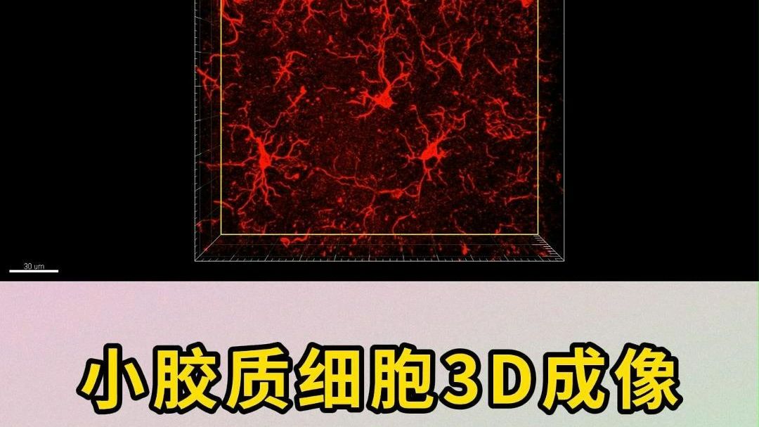 惊呆了!绝美的小胶质细胞免疫荧光3D成像,组织厚切片透明化三维成像!哔哩哔哩bilibili