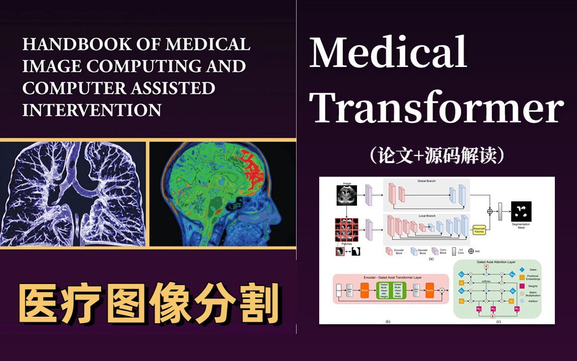 Transformer在实例分割中的应用 | Medical transformer医疗图像分割(论文+源码解读),这应该是时下最热门项目!哔哩哔哩bilibili