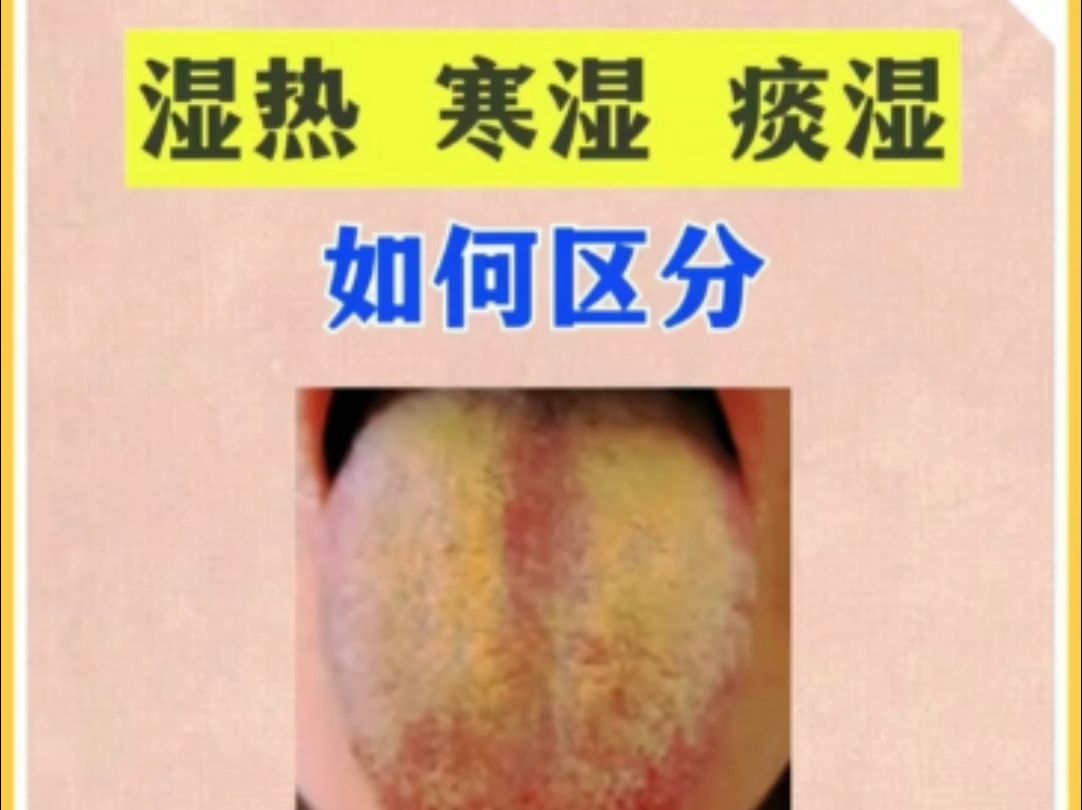 湿热 寒湿 痰湿如何区分