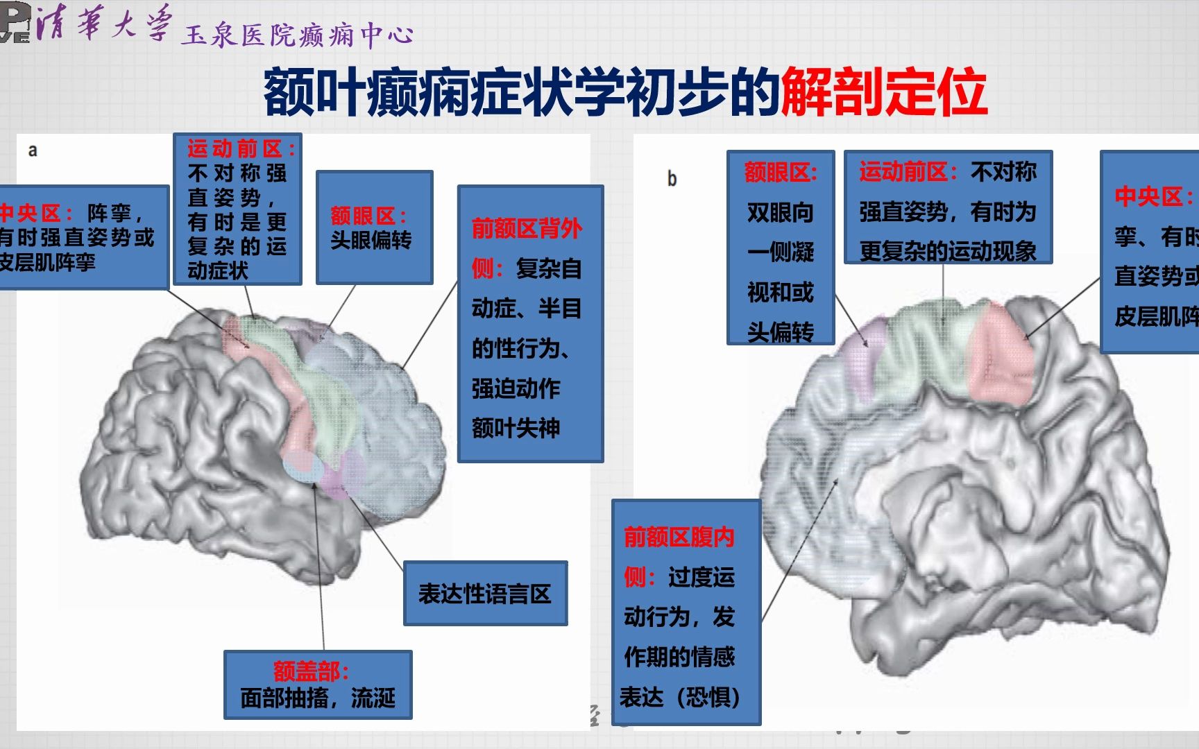 不同额叶皮层癫痫症状学特点哔哩哔哩bilibili