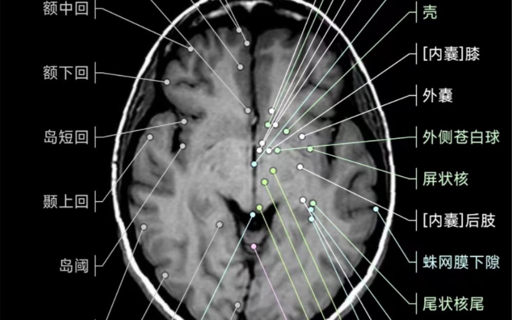 [图]影像解剖图谱神器 医学影像学必备 e-anatomy中文最新版 全身CT（淋巴结）