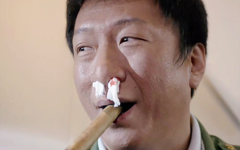 孙红雷:这谁干的,下手这么黑,把牙都打掉了