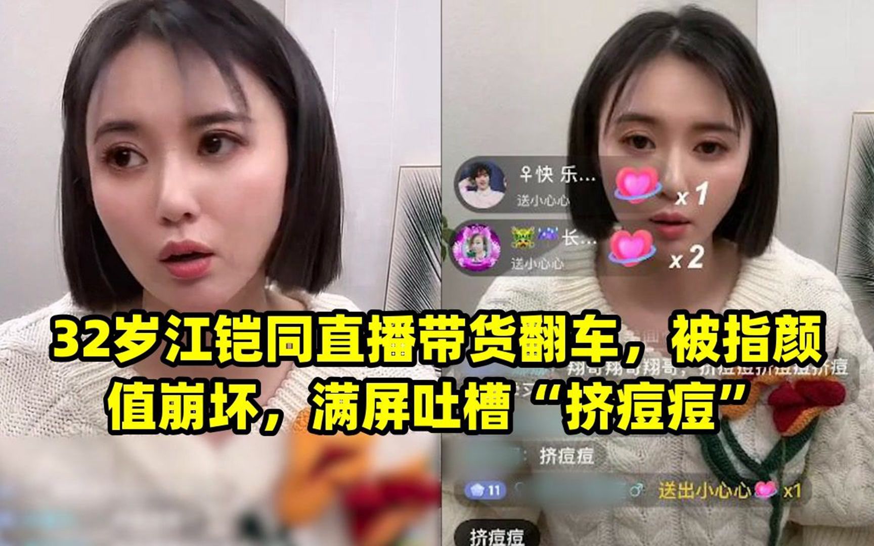 32岁江铠同直播带货翻车,被指颜值崩坏,满屏吐槽"挤痘痘"