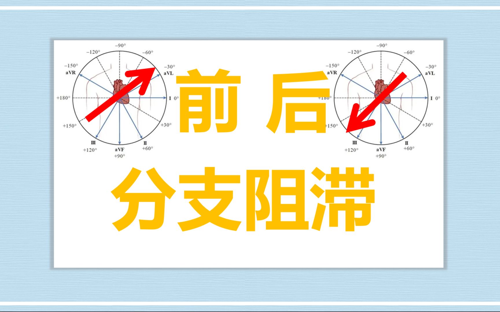 【广药附一】左前分支阻滞、右位心、左右手反接,心电图怎么分辨?哔哩哔哩bilibili