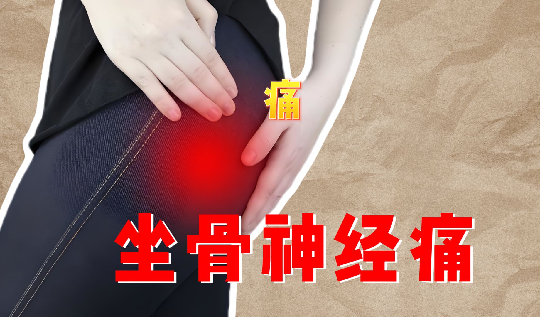 坐骨神经痛还是梨状肌综合征?原因自查