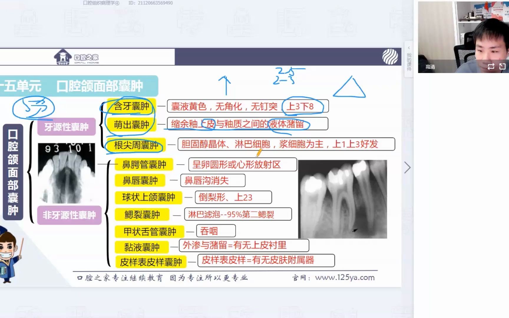 [图]根尖周囊肿