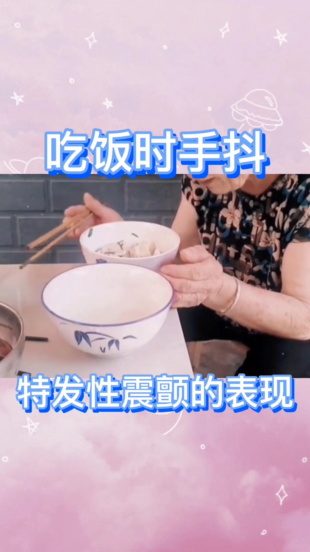 吃饭时手抖特发性震颤的表现