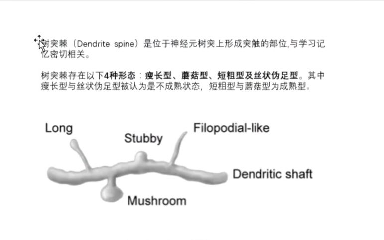 image J软件的使用(医学科研)树突棘密度分析哔哩哔哩bilibili