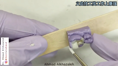 临床树脂嵌体椅旁快速修复by Dr Ahmad Alkhazaleh#树脂#嵌体#牙匠之家哔哩哔哩bilibili