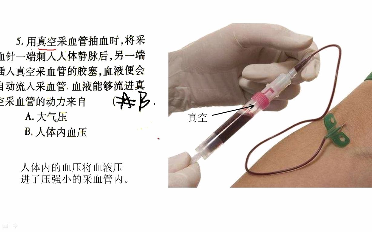 压强题(用真空采血管抽血时,将采血针一端刺入人体静脉后,另一端插入真空采血管的胶塞,血液能够流进真空采血管的动力来自()A.大气压B.人体内血...