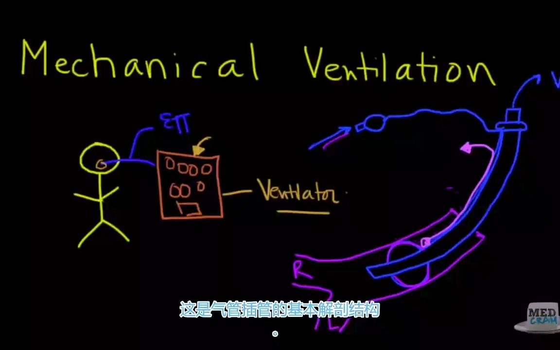 机械通气 mechanical ventilation哔哩哔哩bilibili