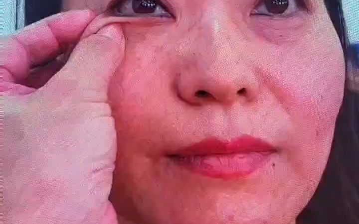 针灸美雕崔兰英现场实操